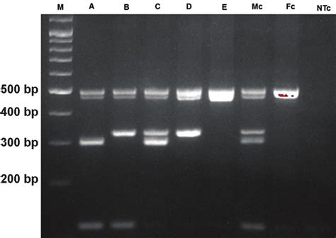 how to read agarose gel electrophoresis results|Agarose Gel Electrophoresis: Results Analysis.